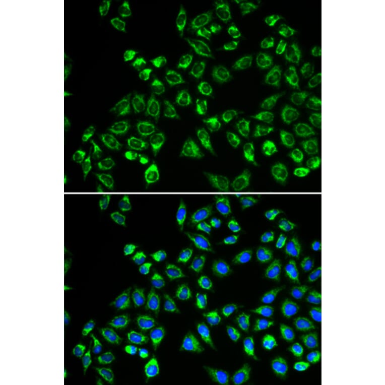 Immunofluorescence - Anti-GC1q R Antibody (A13721) - Antibodies.com