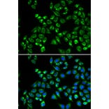 Immunofluorescence - Anti-GC1q R Antibody (A13721) - Antibodies.com