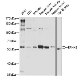 Western Blot - Anti-EPHX2 Antibody (A13722) - Antibodies.com
