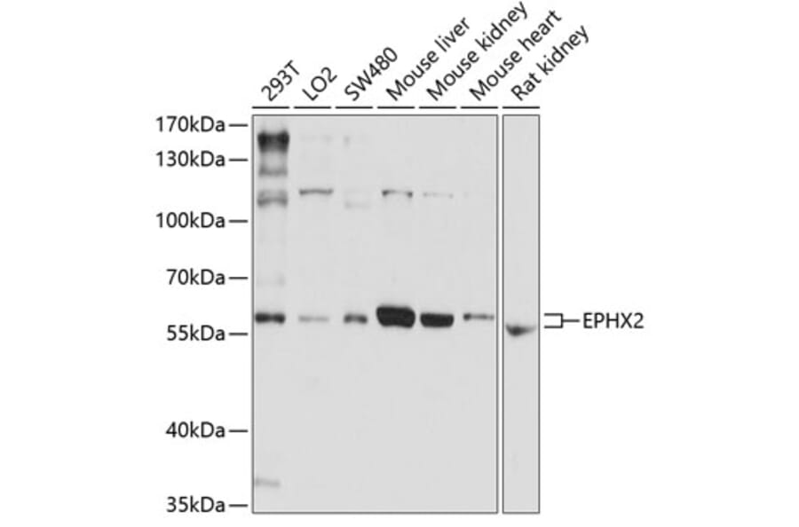 Western Blot - Anti-EPHX2 Antibody (A13722) - Antibodies.com