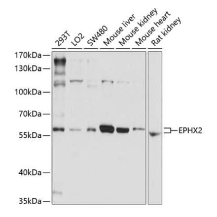 Western Blot - Anti-EPHX2 Antibody (A13722) - Antibodies.com