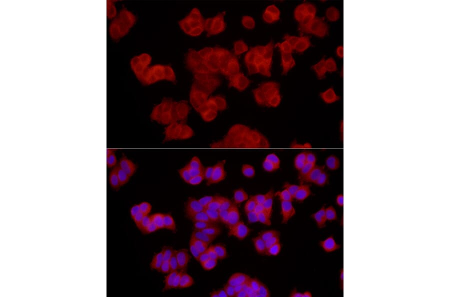 Immunofluorescence - Anti-EPHX2 Antibody (A13722) - Antibodies.com