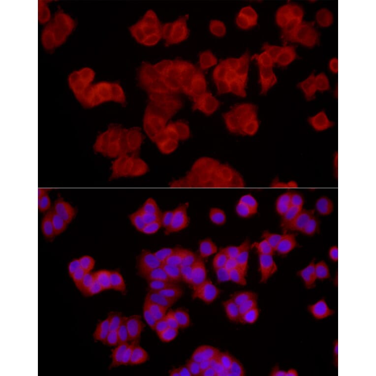 Immunofluorescence - Anti-EPHX2 Antibody (A13722) - Antibodies.com
