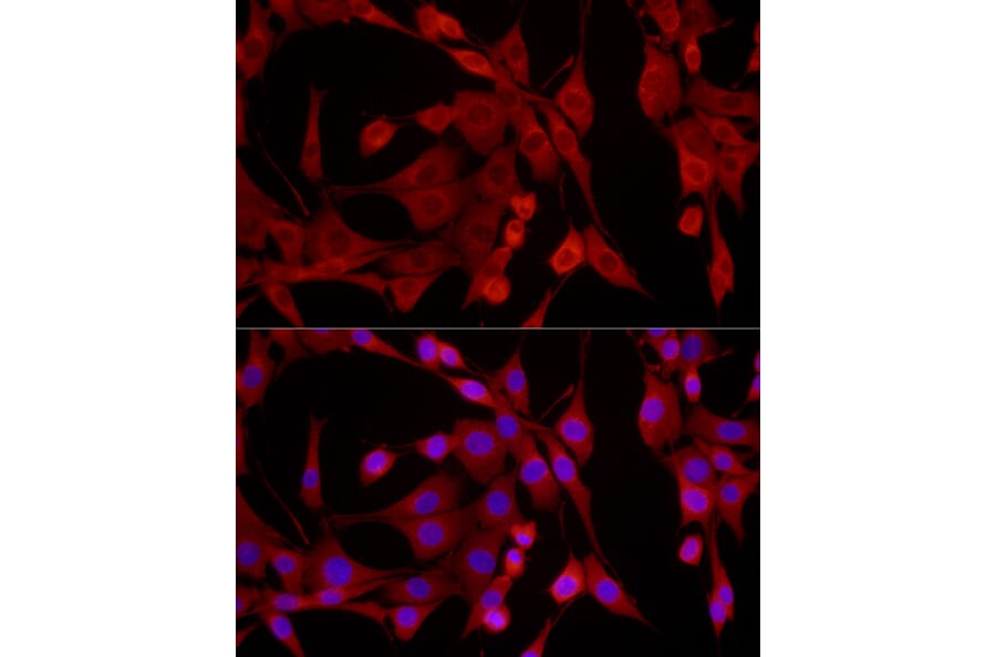 Immunofluorescence - Anti-EPHX2 Antibody (A13722) - Antibodies.com