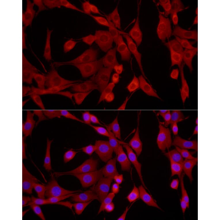 Immunofluorescence - Anti-EPHX2 Antibody (A13722) - Antibodies.com