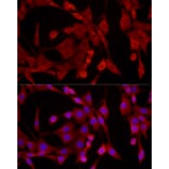 Immunofluorescence - Anti-EPHX2 Antibody (A13722) - Antibodies.com