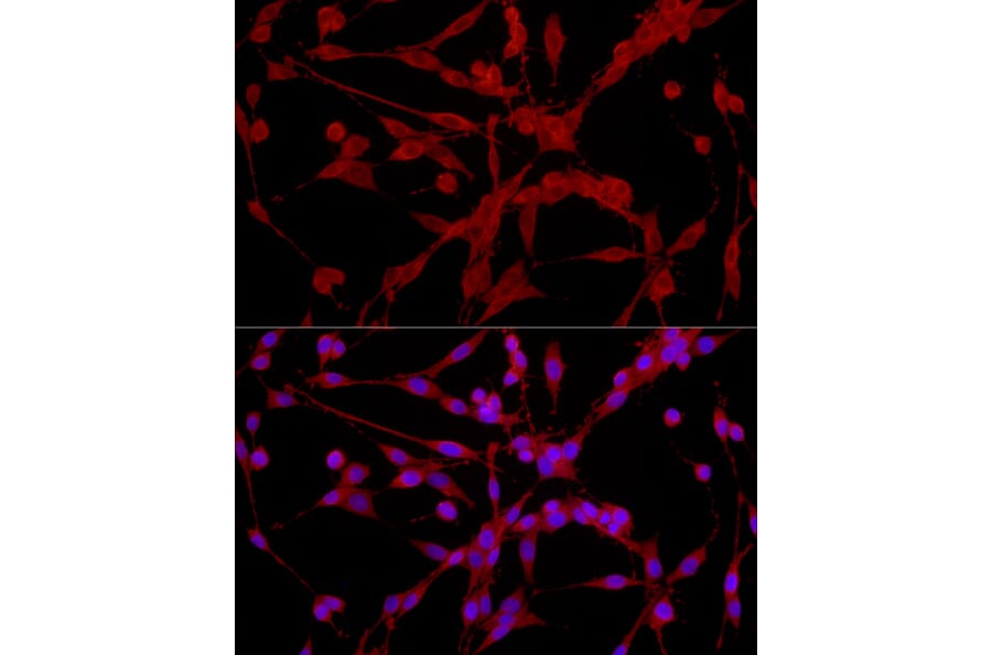 Immunofluorescence - Anti-EPHX2 Antibody (A13722) - Antibodies.com