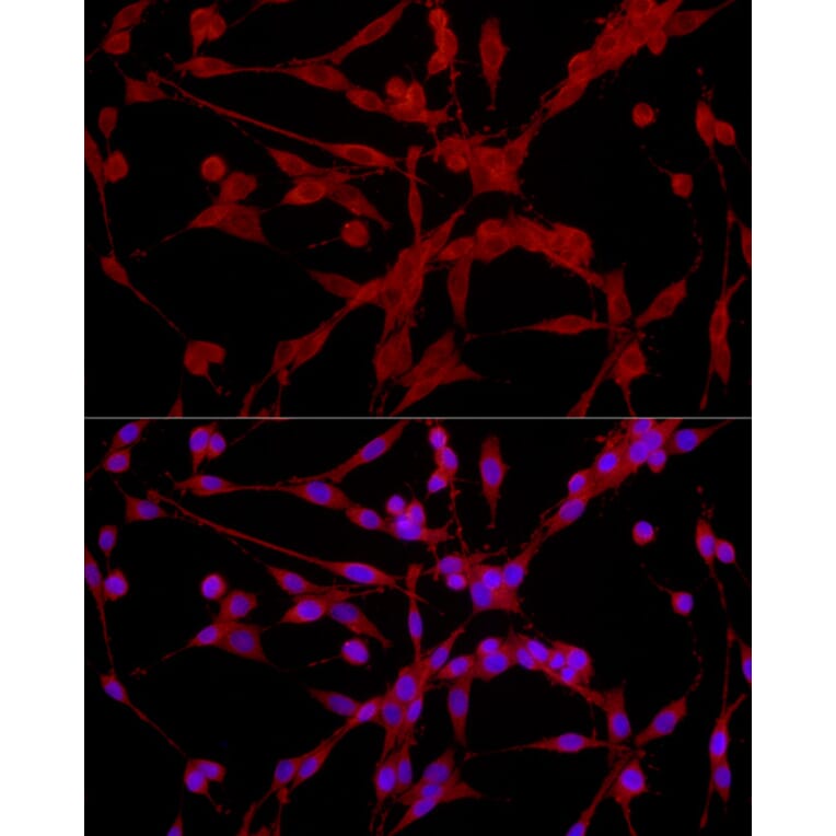 Immunofluorescence - Anti-EPHX2 Antibody (A13722) - Antibodies.com