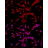 Immunofluorescence - Anti-EPHX2 Antibody (A13722) - Antibodies.com