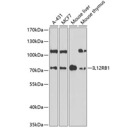 Western Blot - Anti-IL-12RB1 Antibody (A13723) - Antibodies.com