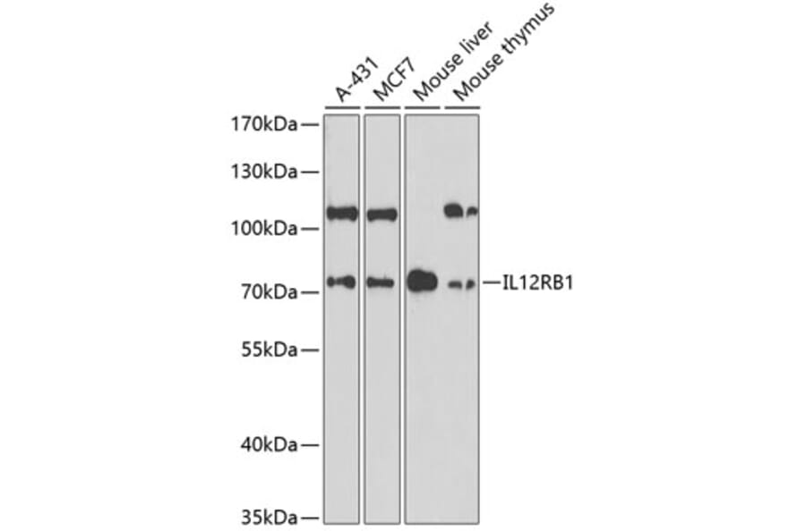 Western Blot - Anti-IL-12RB1 Antibody (A13723) - Antibodies.com
