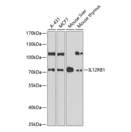 Western Blot - Anti-IL-12RB1 Antibody (A13723) - Antibodies.com