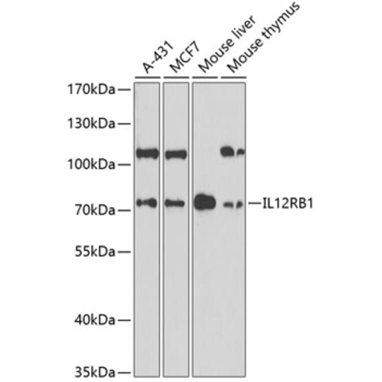 Western Blot - Anti-IL-12RB1 Antibody (A13723) - Antibodies.com