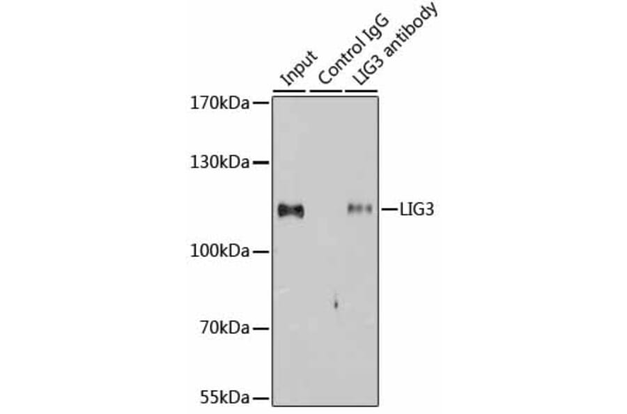 Immunoprecipitation - Anti-LIG3 Antibody (A13724) - Antibodies.com