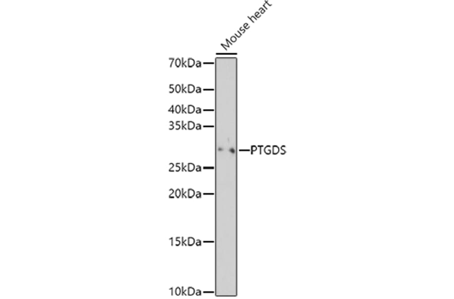 Western Blot - Anti-Prostaglandin D Synthase (Lipocalin)/PDS Antibody (A13725) - Antibodies.com