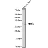 Western Blot - Anti-Prostaglandin D Synthase (Lipocalin)/PDS Antibody (A13725) - Antibodies.com
