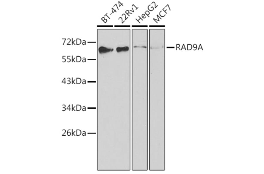Western Blot - Anti-Rad9 Antibody (A13726) - Antibodies.com
