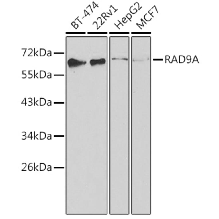 Western Blot - Anti-Rad9 Antibody (A13726) - Antibodies.com