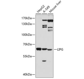Western Blot - Anti-LIPG Antibody (A13727) - Antibodies.com