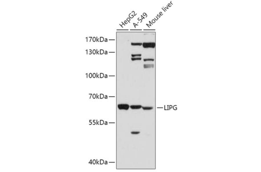 Western Blot - Anti-LIPG Antibody (A13727) - Antibodies.com