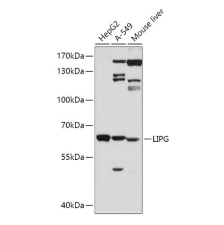 Western Blot - Anti-LIPG Antibody (A13727) - Antibodies.com