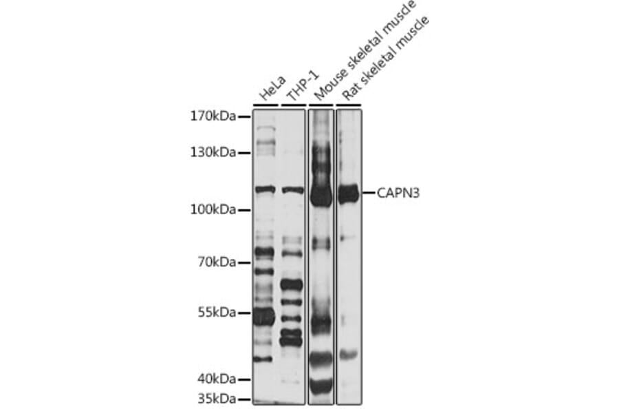 Western Blot - Anti-CAPN3 Antibody (A1893) - Antibodies.com