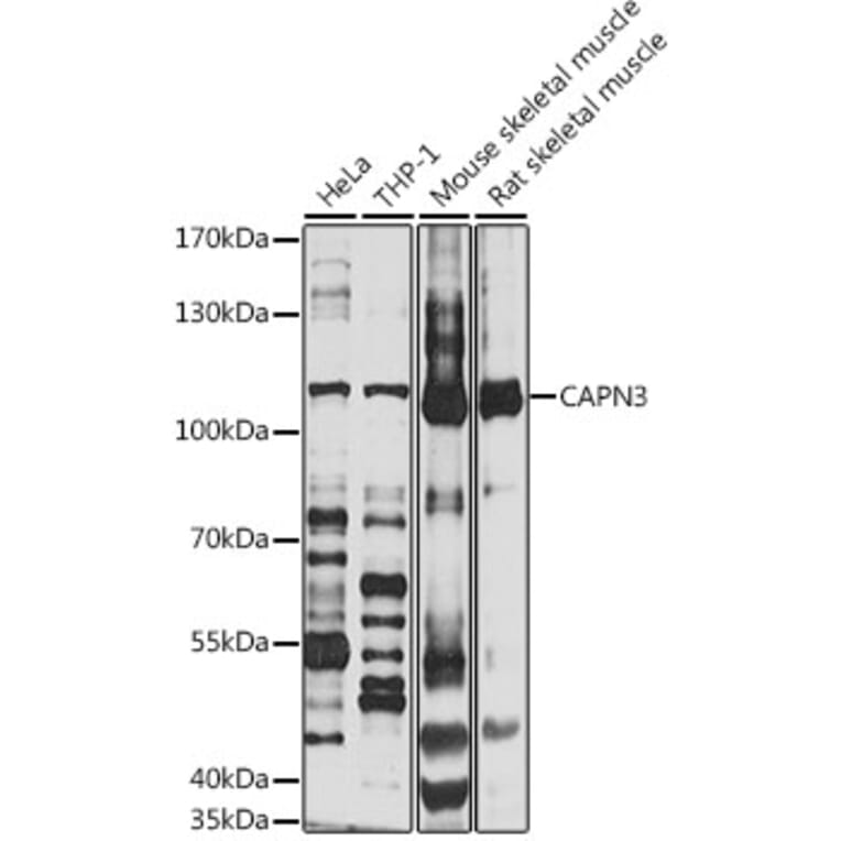 Western Blot - Anti-CAPN3 Antibody (A1893) - Antibodies.com