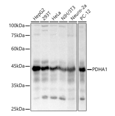 Western Blot - Anti-PDHA1 Antibody (A13729) - Antibodies.com