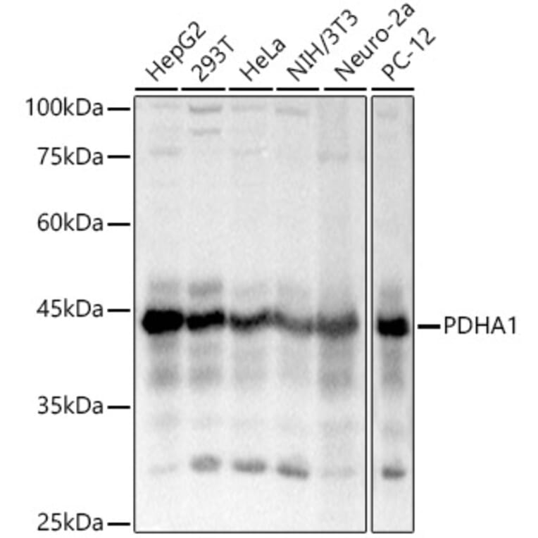 Western Blot - Anti-PDHA1 Antibody (A13729) - Antibodies.com