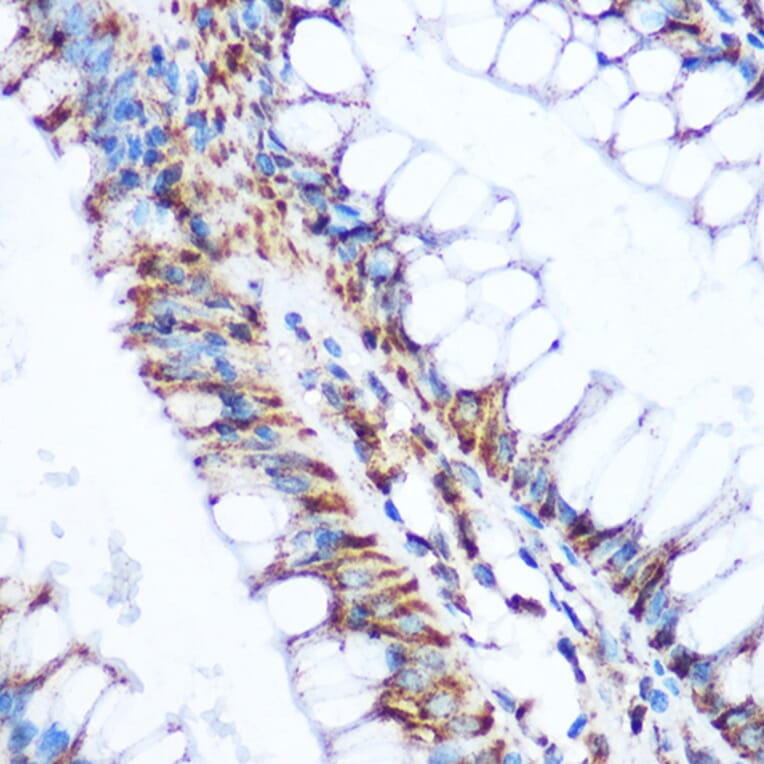 Immunohistochemistry - Anti-PDHA1 Antibody (A13729) - Antibodies.com