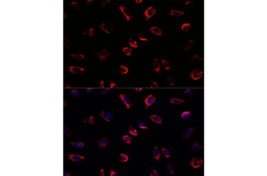 Immunofluorescence - Anti-IL-11 Antibody (A13731) - Antibodies.com