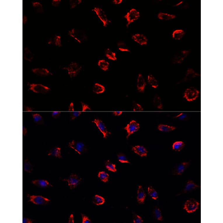 Immunofluorescence - Anti-IL-11 Antibody (A13731) - Antibodies.com