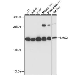 Western Blot - Anti-LMO2 Antibody (A13732) - Antibodies.com