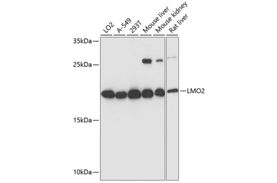 Western Blot - Anti-LMO2 Antibody (A13732) - Antibodies.com