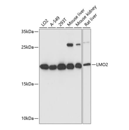 Western Blot - Anti-LMO2 Antibody (A13732) - Antibodies.com