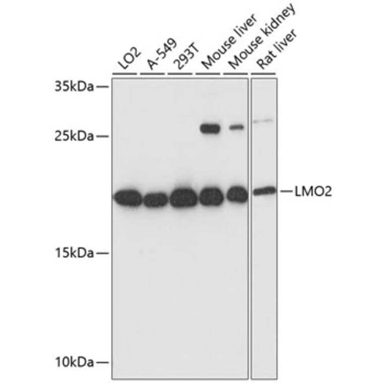 Western Blot - Anti-LMO2 Antibody (A13732) - Antibodies.com