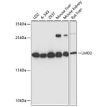 Western Blot - Anti-LMO2 Antibody (A13732) - Antibodies.com