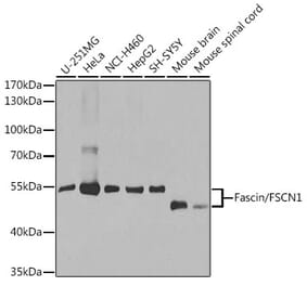 Western Blot - Anti-Fascin Antibody (A13733) - Antibodies.com