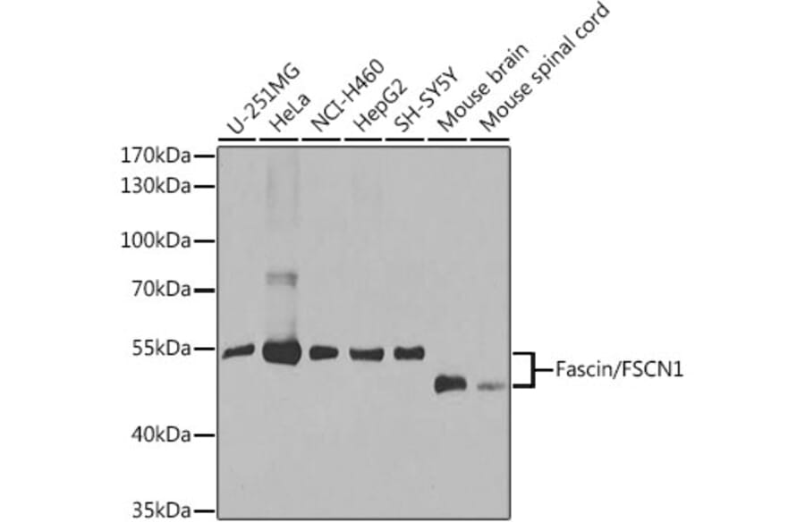 Western Blot - Anti-Fascin Antibody (A13733) - Antibodies.com