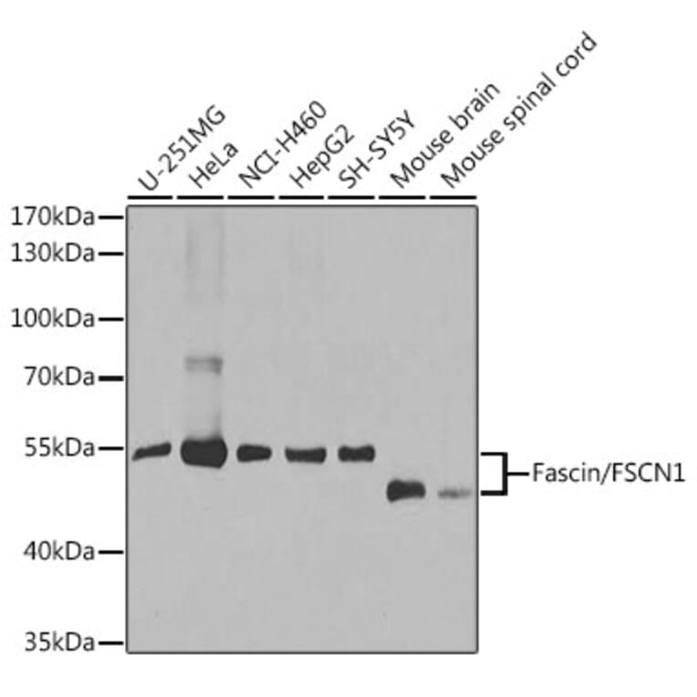 Western Blot - Anti-Fascin Antibody (A13733) - Antibodies.com