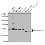 Western Blot - Anti-Fascin Antibody (A13733) - Antibodies.com