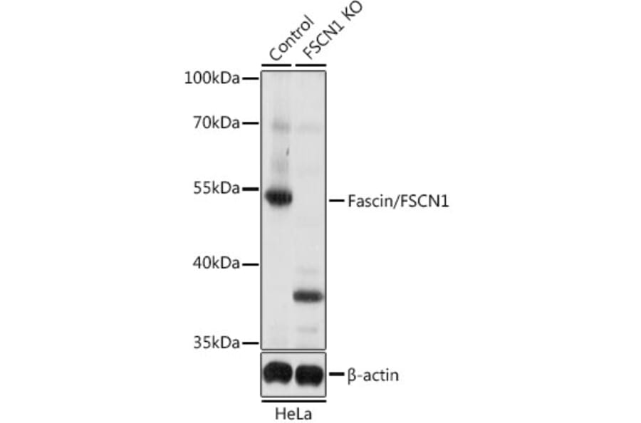 Western Blot - Anti-Fascin Antibody (A13733) - Antibodies.com