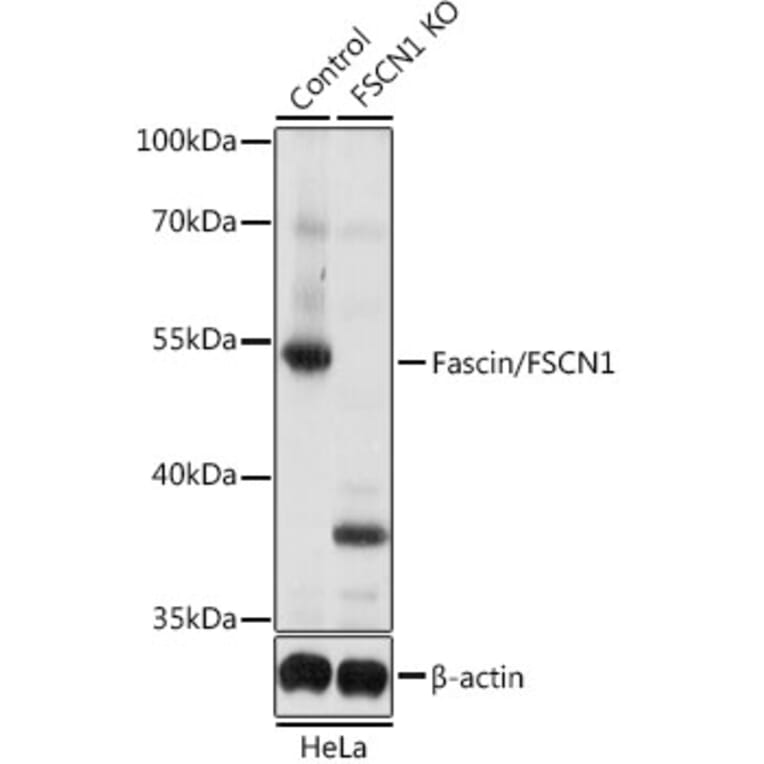 Western Blot - Anti-Fascin Antibody (A13733) - Antibodies.com