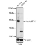 Western Blot - Anti-Fascin Antibody (A13733) - Antibodies.com