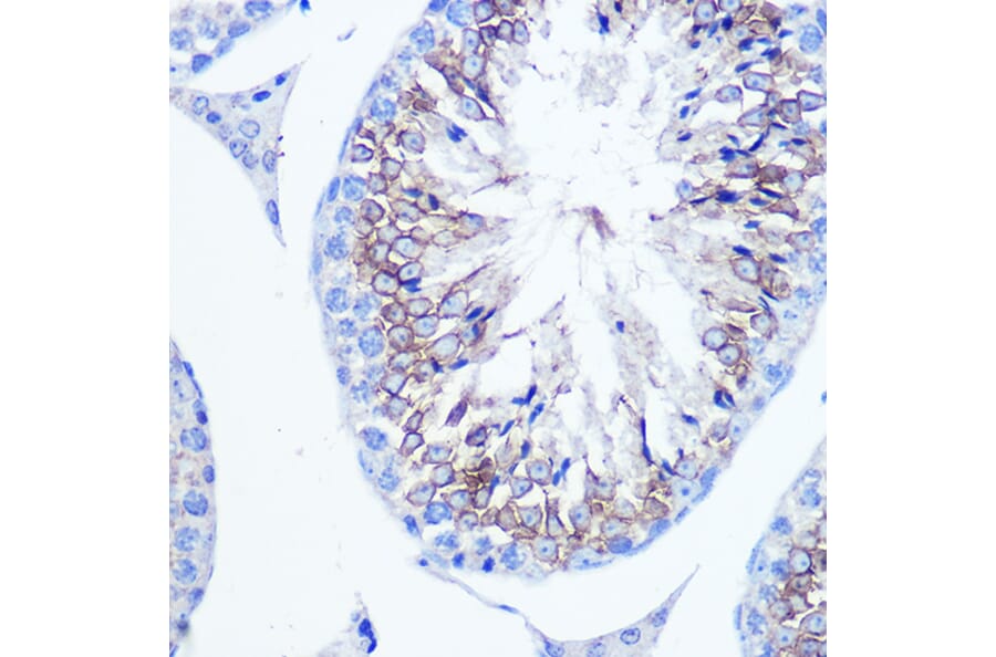 Immunohistochemistry - Anti-Fascin Antibody (A13733) - Antibodies.com