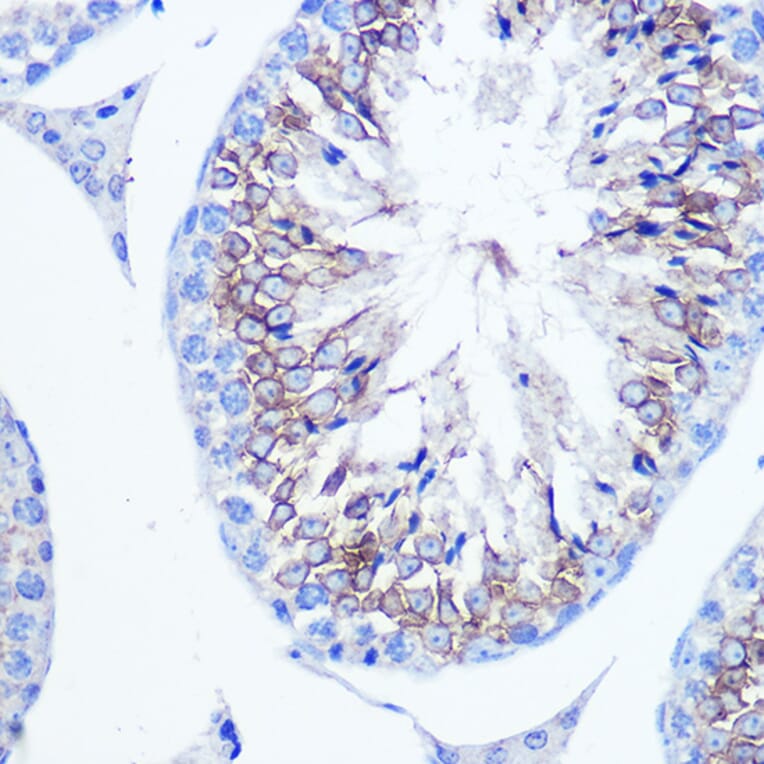 Immunohistochemistry - Anti-Fascin Antibody (A13733) - Antibodies.com