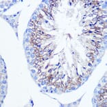 Immunohistochemistry - Anti-Fascin Antibody (A13733) - Antibodies.com