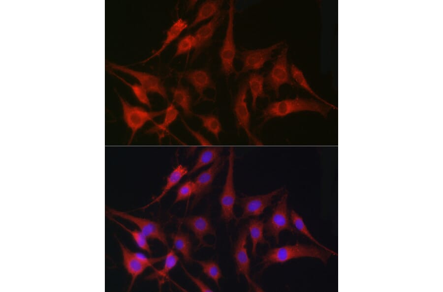 Immunofluorescence - Anti-Fascin Antibody (A13733) - Antibodies.com