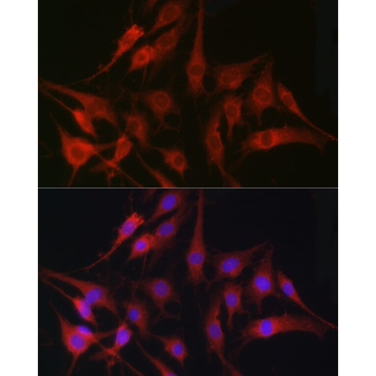 Immunofluorescence - Anti-Fascin Antibody (A13733) - Antibodies.com