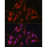 Immunofluorescence - Anti-Fascin Antibody (A13733) - Antibodies.com